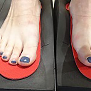 Bouchier; inlegzolen op maat Bouchier; inlegzolen op maat